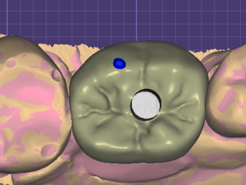 Dental Cad-Service: IMPLANT CROWN AND BRIDGE