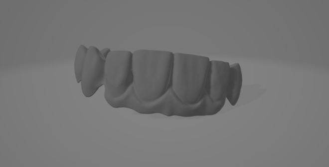 Crown & Bridge CAD Design - CadCam Masters