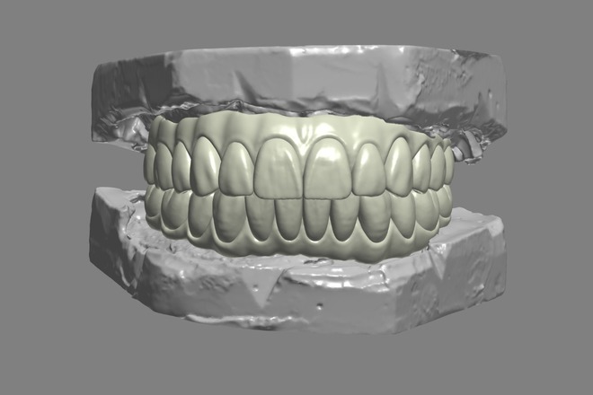 Denta Cad designer - CadCam Masters