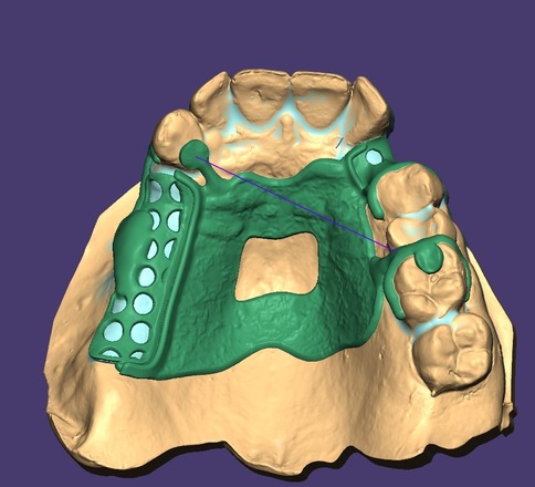 PPR - CadCam Masters