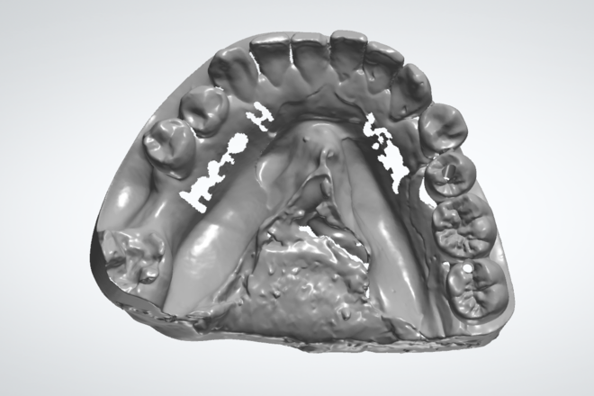 Dentes/Provisórios sob/Implantes - CadCam Masters