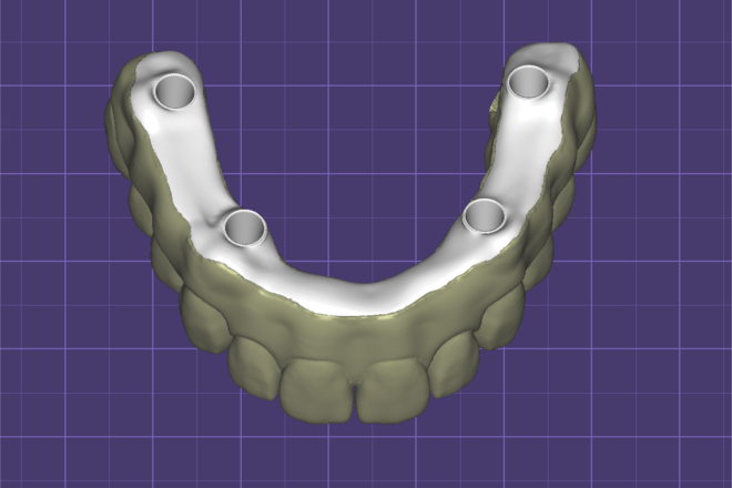 I Bar for All on X - CadCam Masters