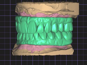 Dental Cad Service: All on X - Full arch over implants