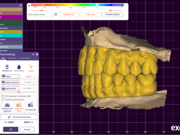Dental Cad Service: full arch immediate/longterm AOX prothesis