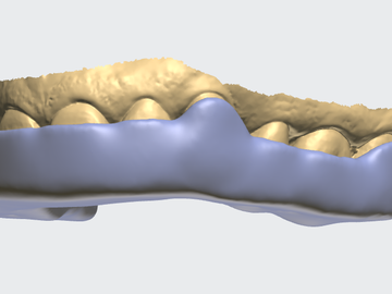 Dental Cad Service: FERULA DE DESCARGA