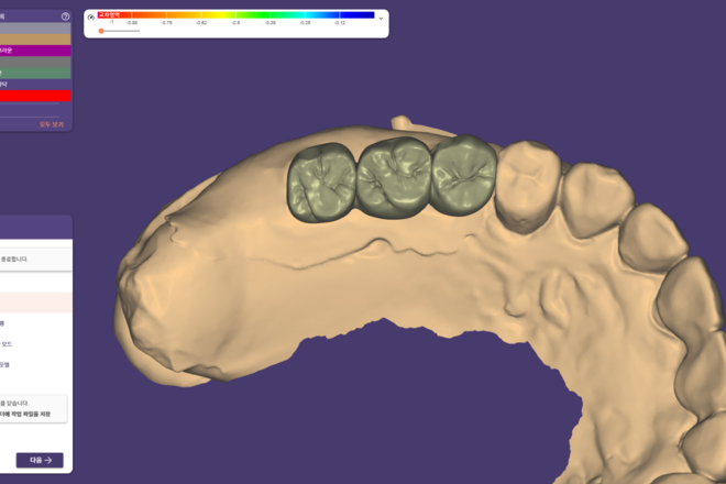 Implant crown bridge - CadCam Masters