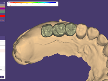 Dental Cad Service: Implant crown bridge