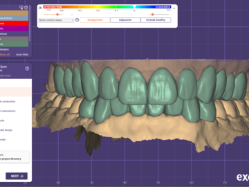 Dental Cad Service: full coverage/ reduced crowns and bridges