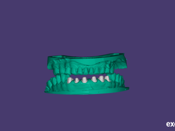 Dental Cad Service: Model for mockups, try-ins