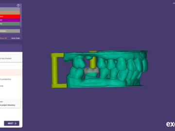 Dental Cad Service: Adjusted inlays/ onlays