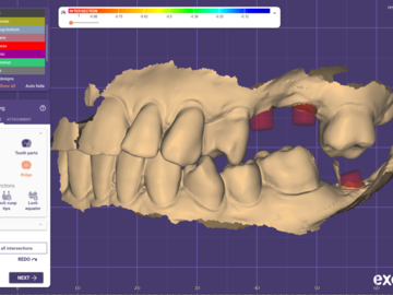 Dental Cad Service: implant crowns/ bridges 