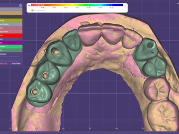 Dental Cad Service: implant crowns/ bridges 