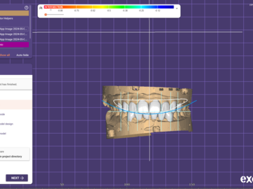 Dental Cad Service: multi-purpose Provisional/ prova mockups 