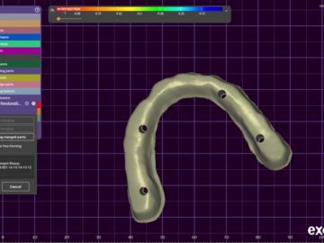 Dental Cad Service: I bar blender full arch