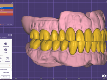 Serviço de Cad Dental: full digital dentures