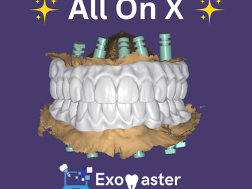 Dental Cad Service: All on X Restorations