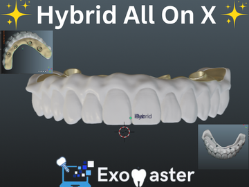 Dental Cad Service: Hybrid All on X 