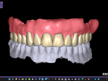 Dental Cad Service: Full denture