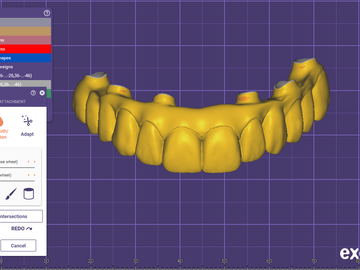 Dental Cad Service: Implant bridge
