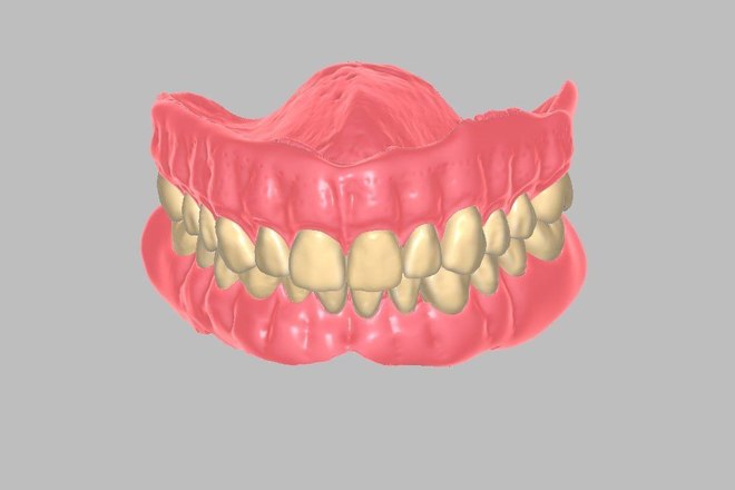 Full denture - CadCam Masters