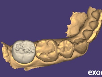 Dental Cad Service: [Designed By Clinician] C&B CAD Design | Occlusion-Focused