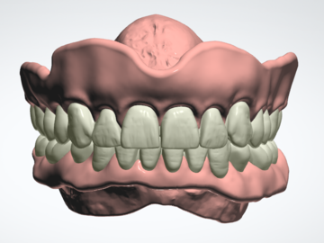 Dental Cad Service: Copy Denture 