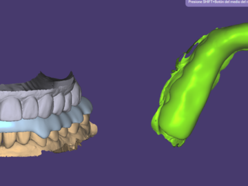 Dental Cad Service: FÉRULA DE DESCARGA