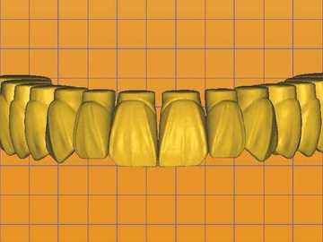 Dental Cad-Service: Planejamento Digital / Digital Planning