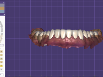 Servicio de Cad Dental: Waxup
