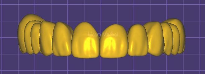 Digital Designs - CadCam Masters