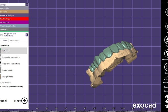 Crown and bridge - CadCam Masters