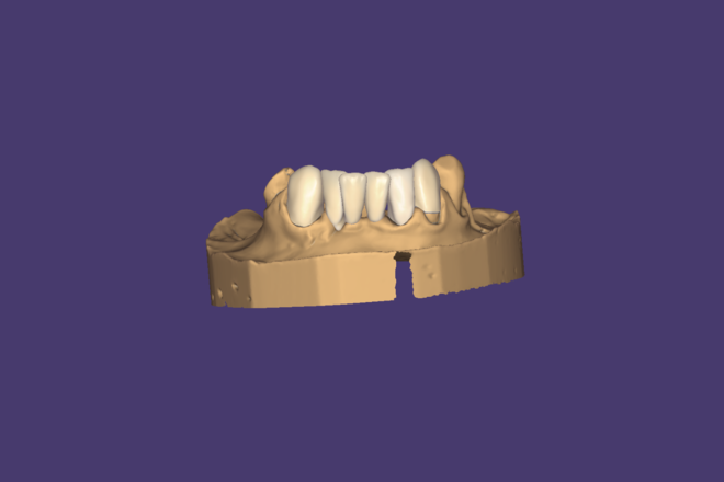living prosthetics - CadCam Masters