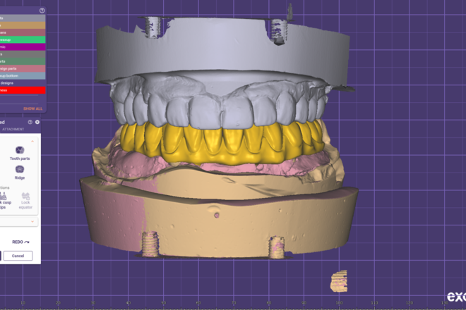Full arch over implants - CadCam Masters
