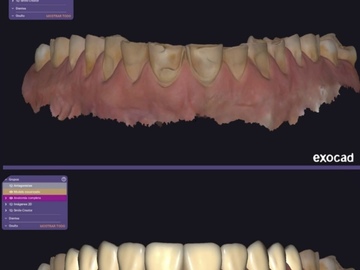 Dental CAD Design - CadCam Masters
