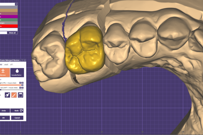 Crown and Bridge Design - CadCam Masters