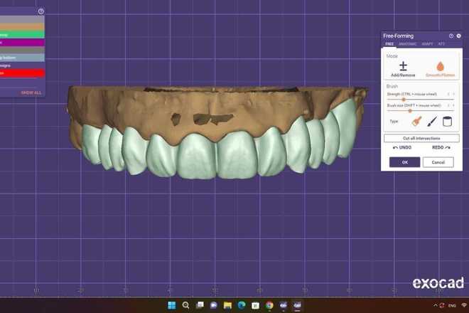Crown and Bridge - CadCam Masters