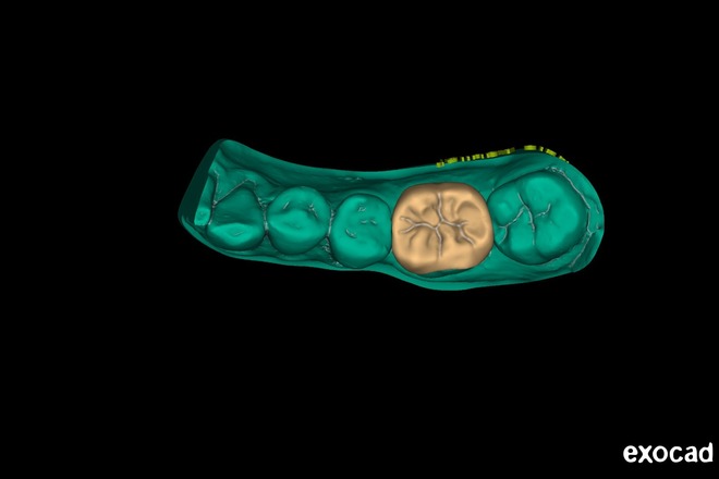 Overlay - CadCam Masters