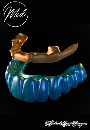 All kinds of projects on exocad