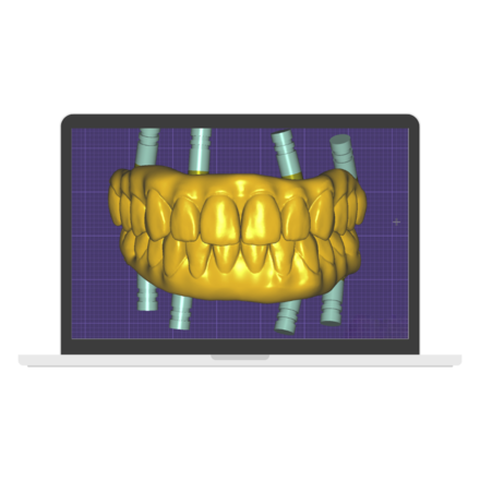 Crown and Bridge - CadCam Masters