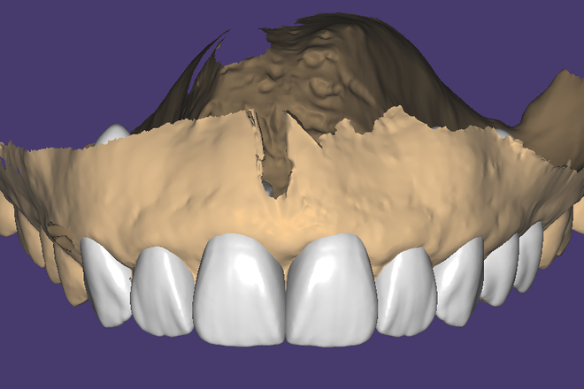 crown & bridge - CadCam Masters
