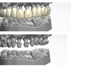 CadCam Masters - Contrate cadistas freelance remotos de cad dental em ...