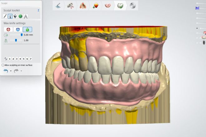 FULL / PARTIAL DENTURES - CadCam Masters