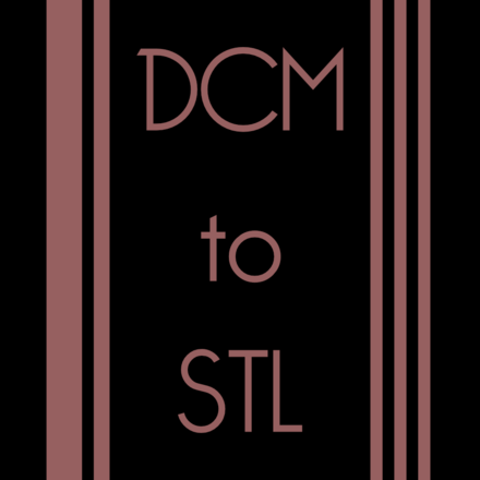 3Shape DCM to STL