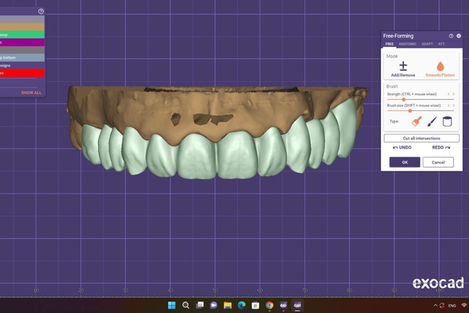 Crown and Bridge - CadCam Masters