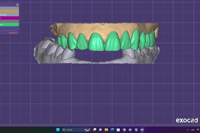 Crown and Bridge Wax up - CadCam Masters
