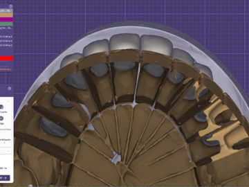 Dental Cad Service: Digital Smile Design Planning & Smile Creator
