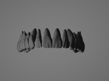 Serviço de Cad Dental: Diseño Coronas Anatomicas Profesionales