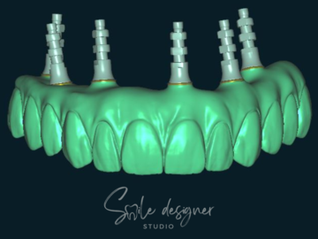 Dental Cad Service: Reliable design services
