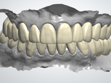 Dental Cad Service: Full mouth - wax up