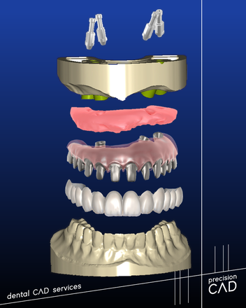 Full anatomic all-on-x - CadCam Masters